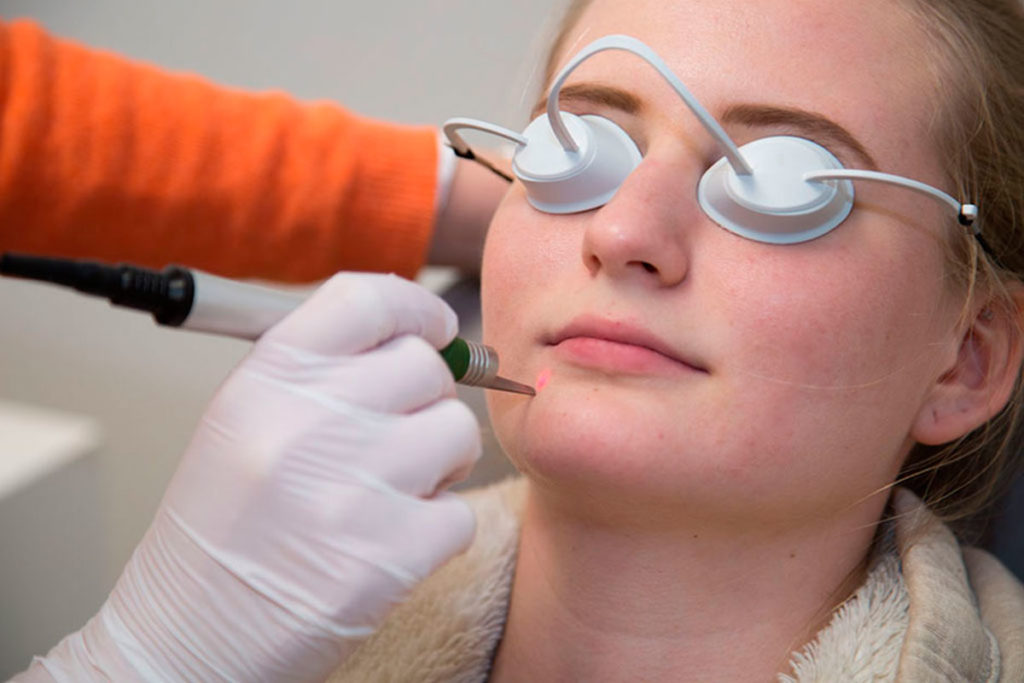 Lasertherapie Laserbehandlung Sthetische Lasermedizin